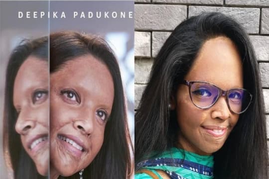 Beberapa Kali Tolak Naskah Biografi, Deepika Padukone Beberkan Alasan Mantap Pilih Kisah Hidup Laxmi Agarwal